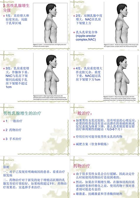 男生 胸|男性乳腺发育症的自我简易判断